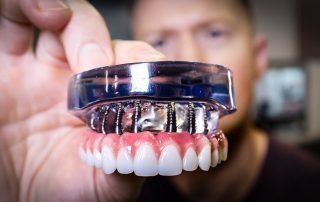 dantu implantai
