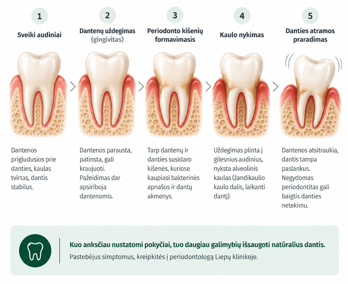 Periodontitologas klaipeda Periodontitologas klaipeda