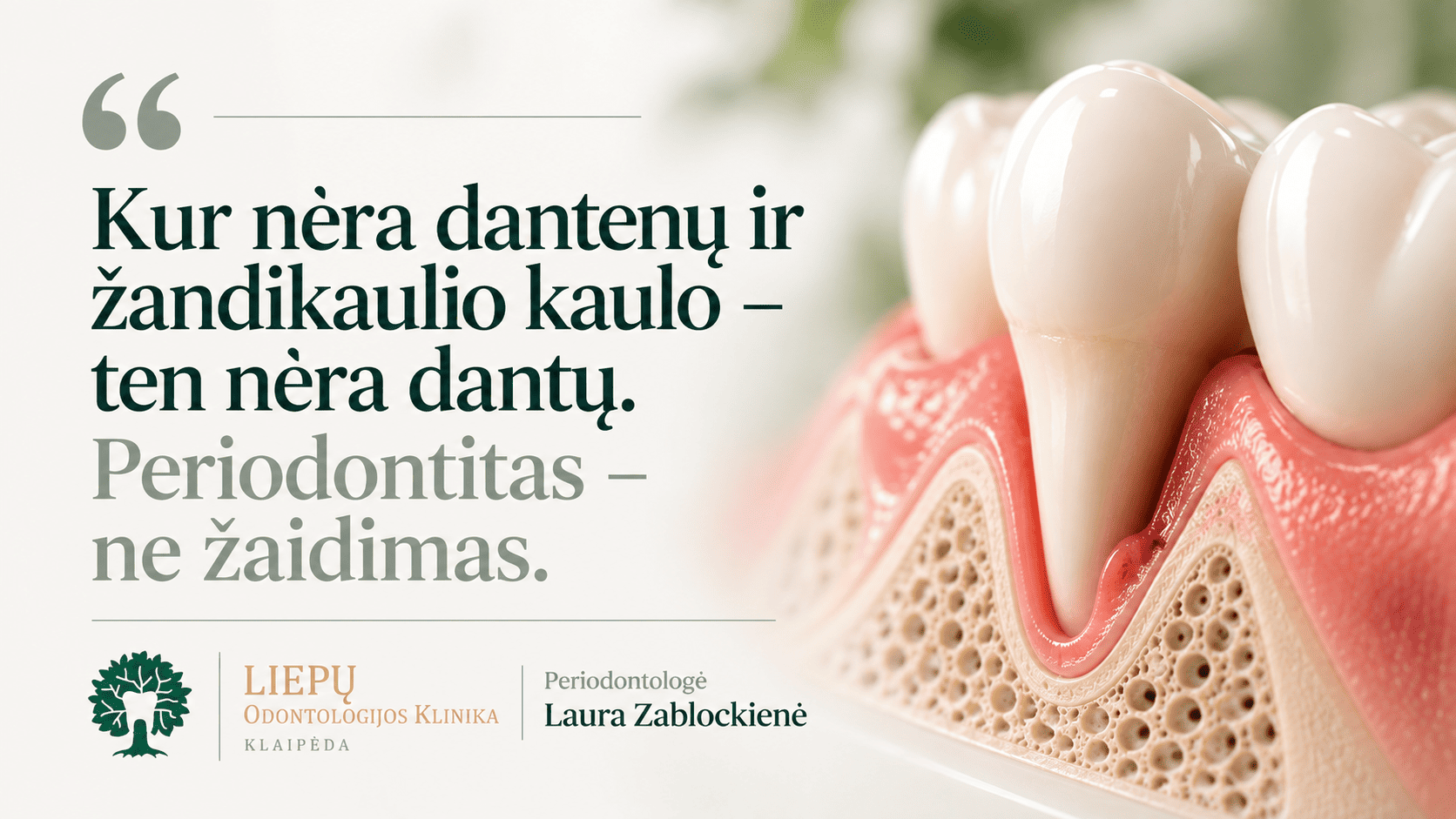 Periodontitologas klaipedoje Periodontitologas klaipedoje